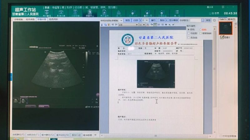 居家慢性病护理：科学步骤与注意事项**